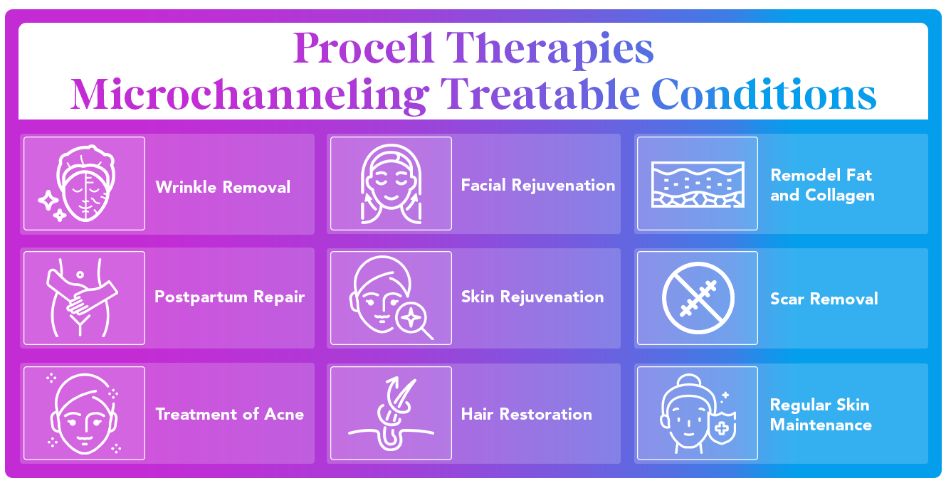 procell therapies microchanneling infographic