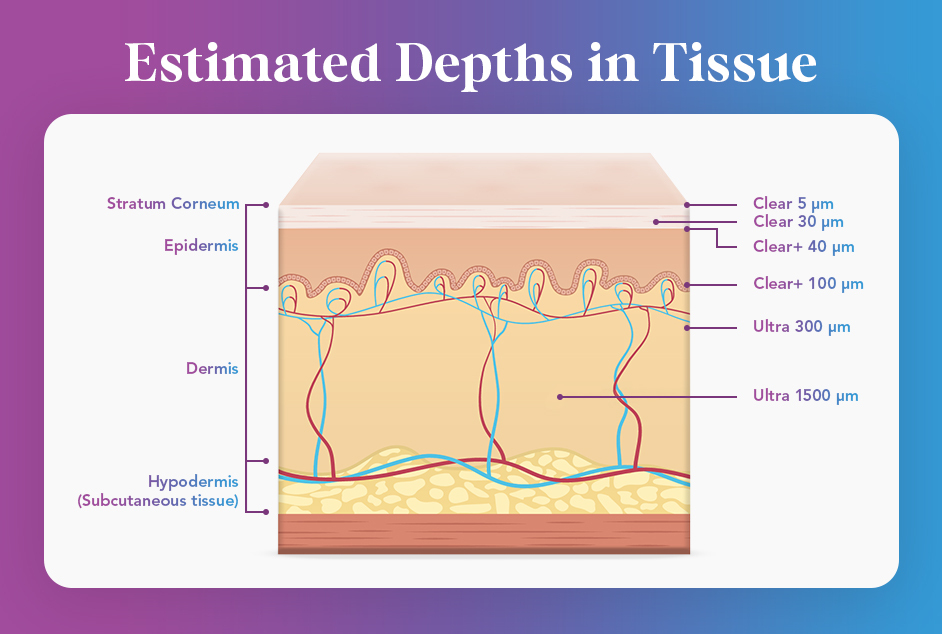 skin tissue infographic
