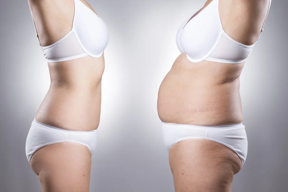 semaglutide lowest cost Weight Loss Options in Gilbert: Unveiling Costs & Benefits of Semaglutide