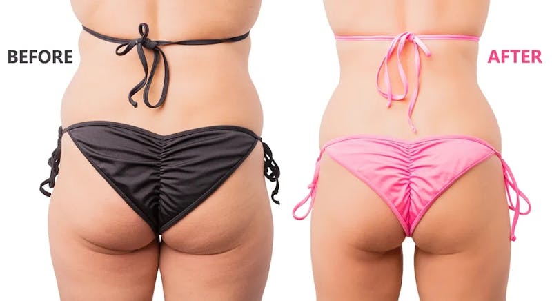weight loss results