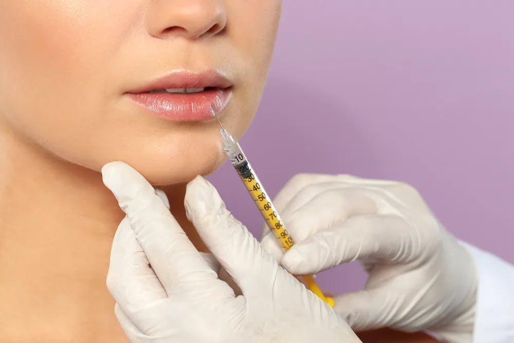 woman getting lip fillers