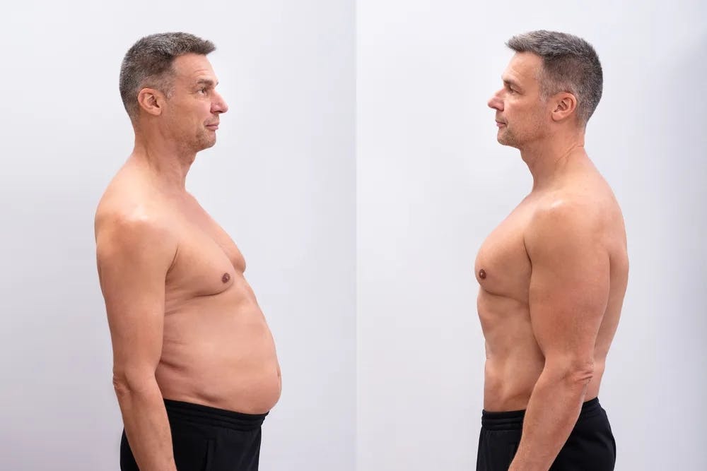 semaglutide leg injection Does Injection Site Matter for Ozempic? MD Tips for Better Results