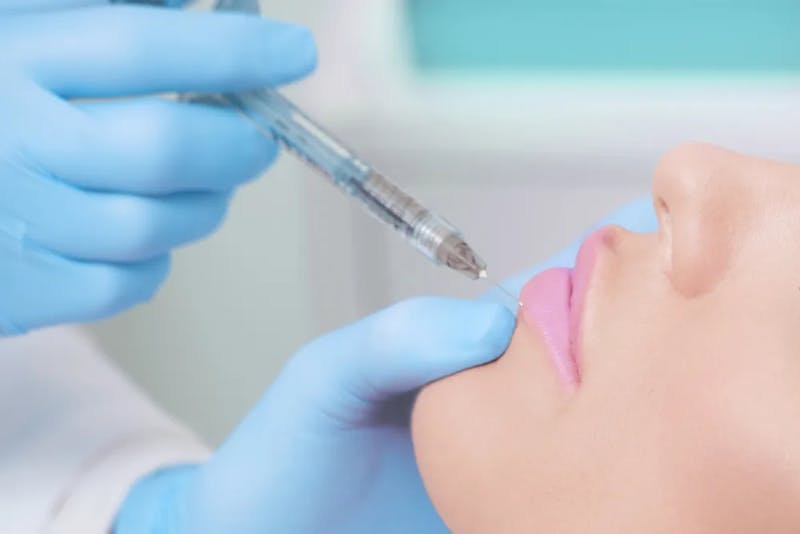 woman getting lip injections