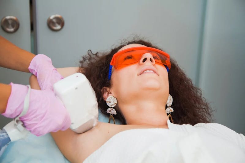 woman getting laser hair removal