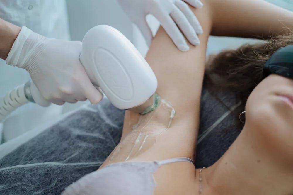 woman getting laser hair removal under armpit