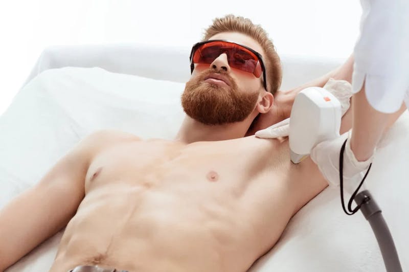 man getting laser hair removal in arm pits