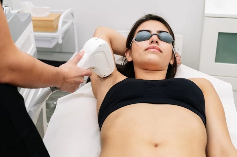 woman getting laser hair removal