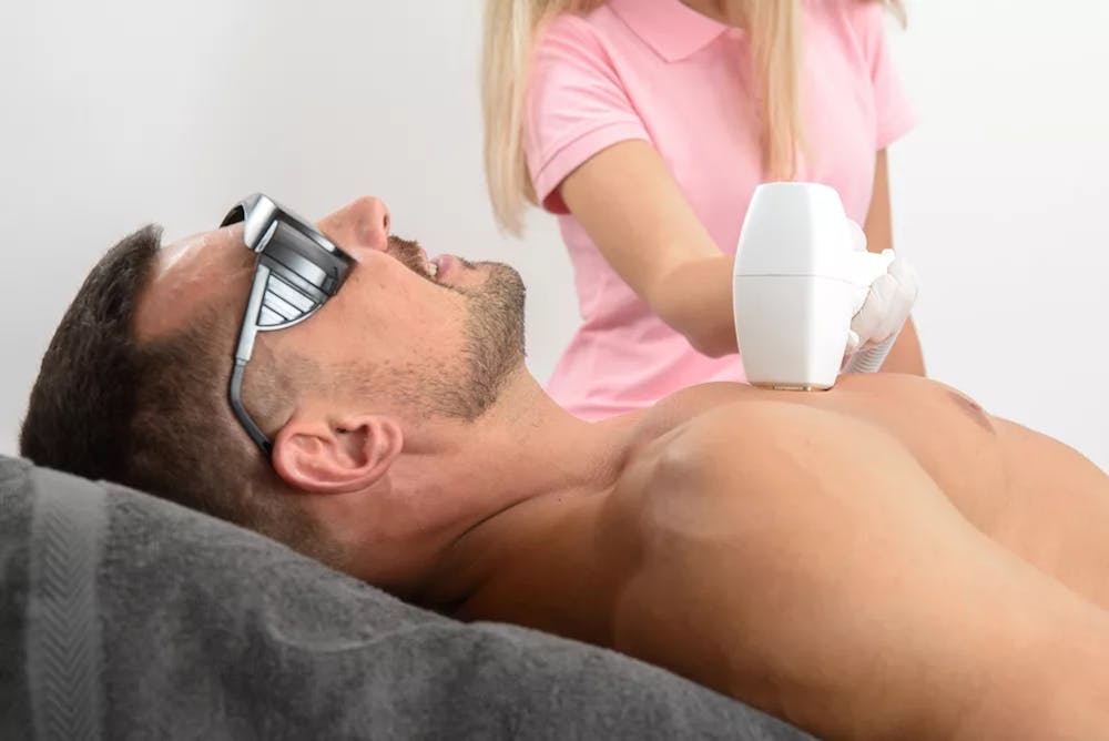 man getting laser hair removal