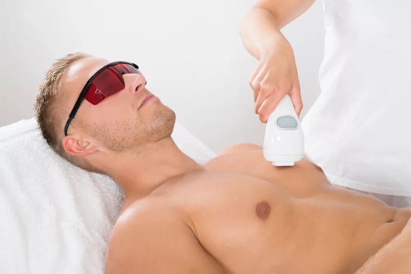 man undergoing laser hair removal
