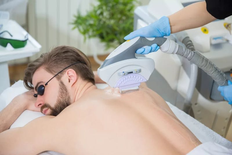 man getting laser hair removal on his back