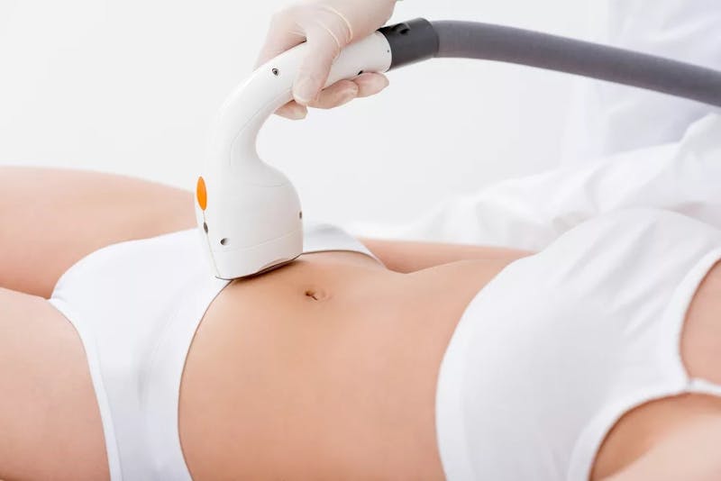 woman getting laser hair removal