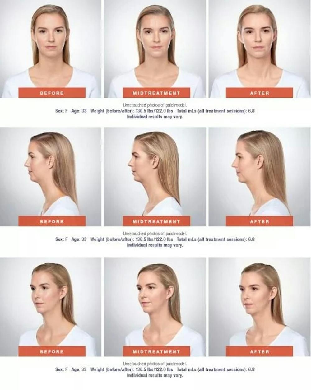 before and afters