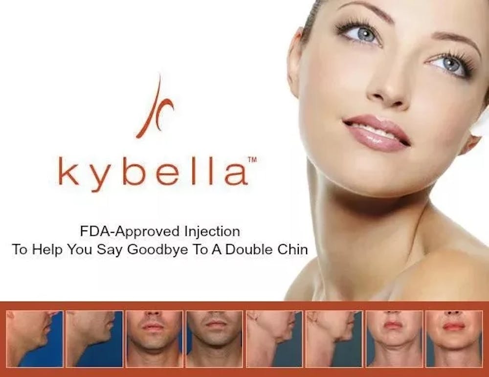 kybella logo and before and afters