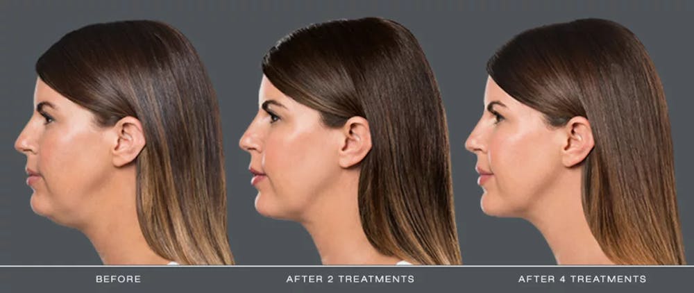 before and after images