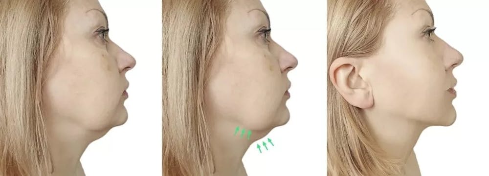 before and after images