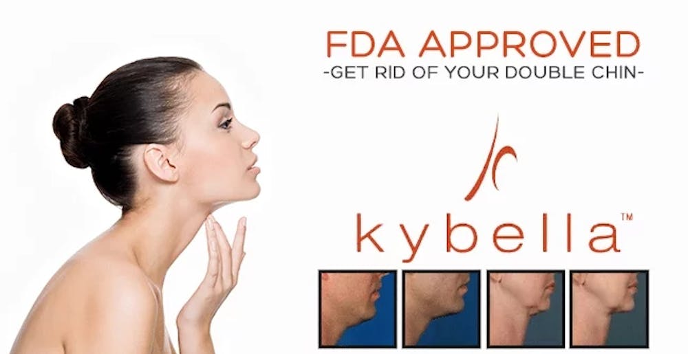 kybella graphic