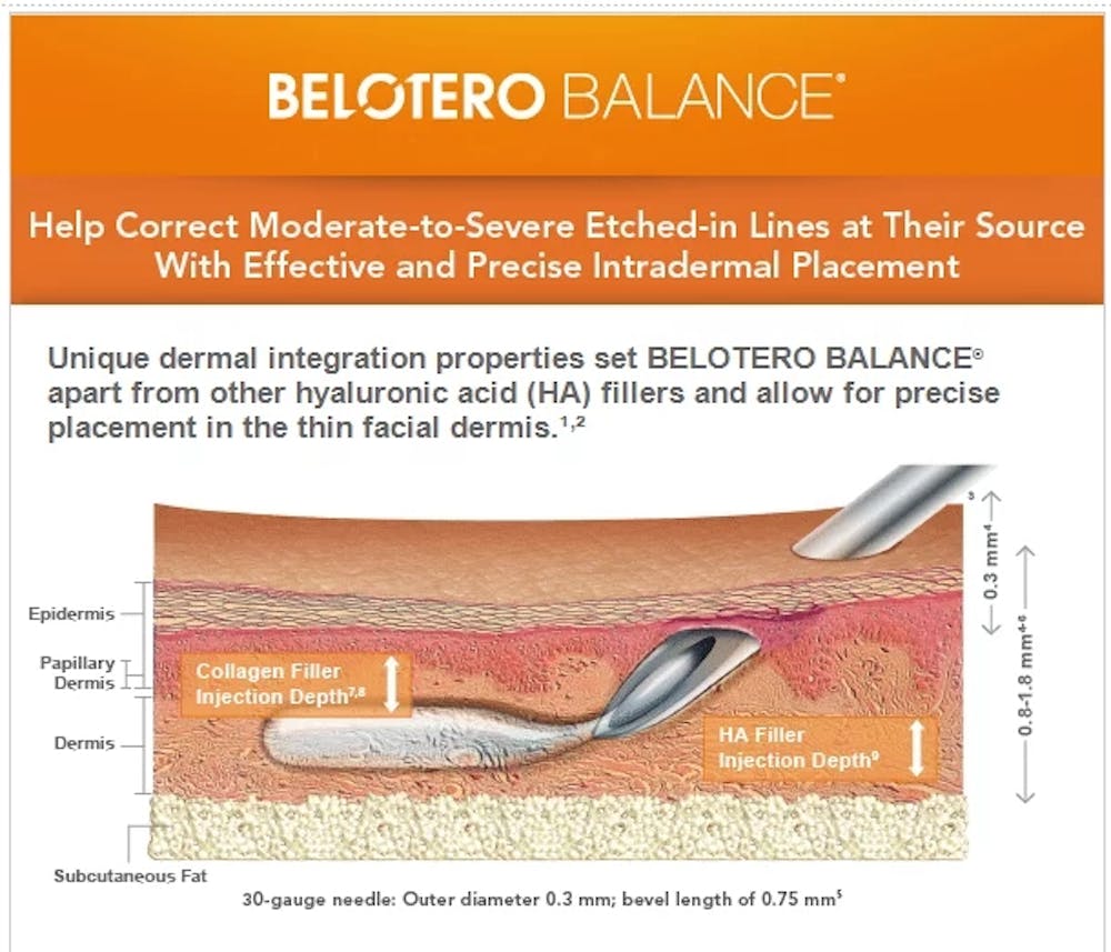 Belotero Balance infographic