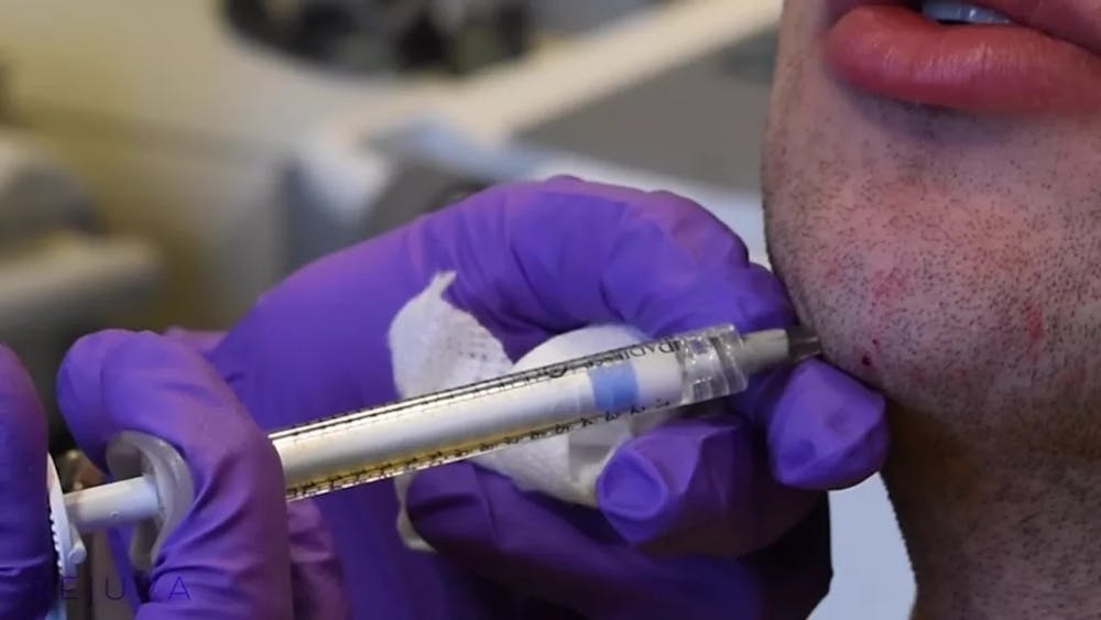 man getting dermal filler
