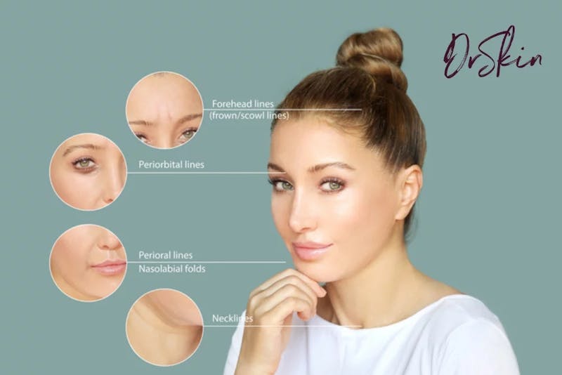 filler graphic