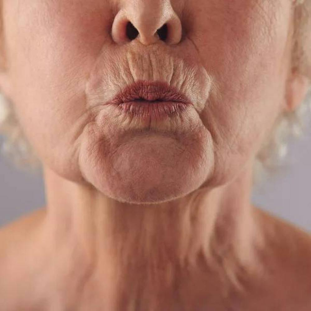 lines around a woman's lips