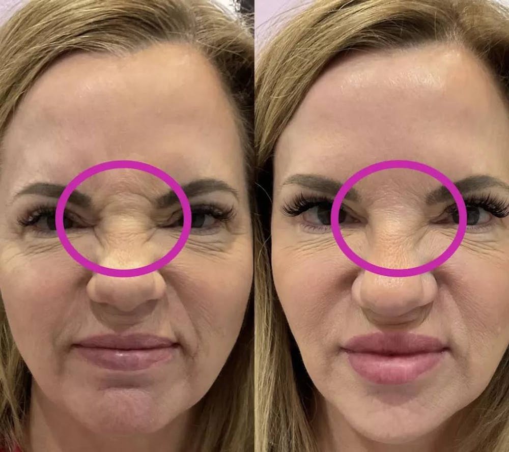 before and after images