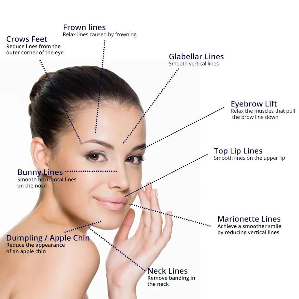 injections site graphic