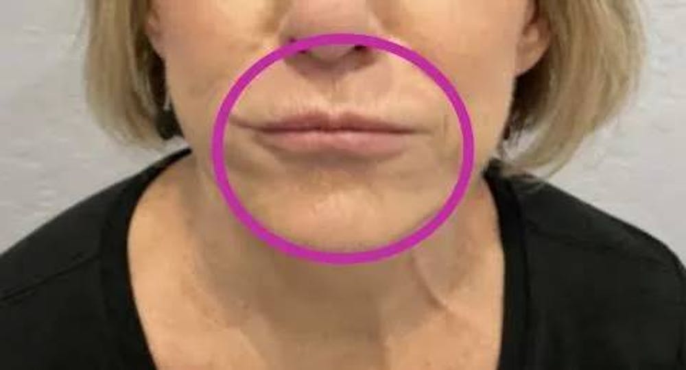 lips