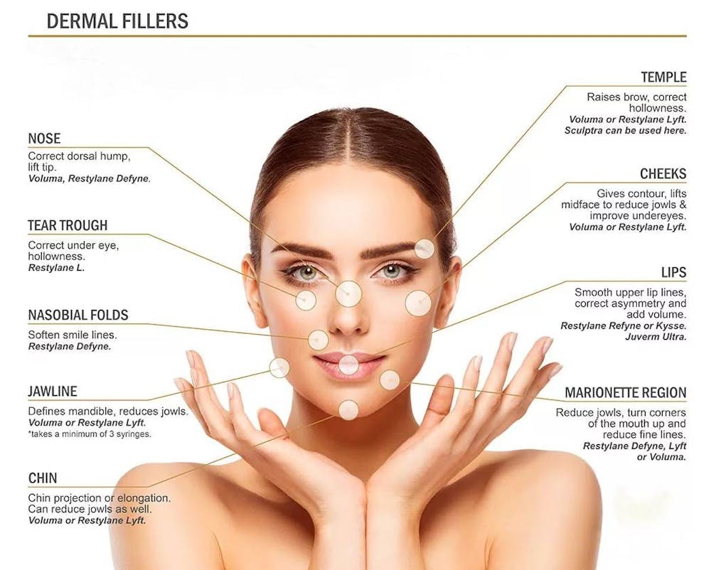 dermal fillers infographic