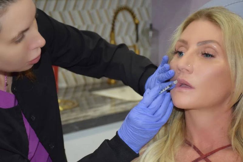 woman getting lip injections