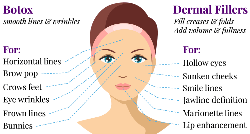 botox and dermal fillers graphic