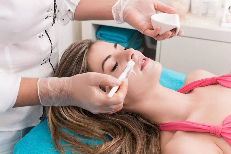 woman getting chemical peel
