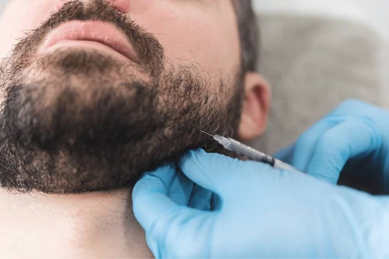 man getting botox