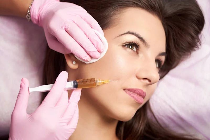 woman with filler