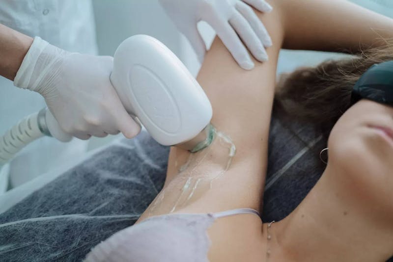 women getting hair removal treatment