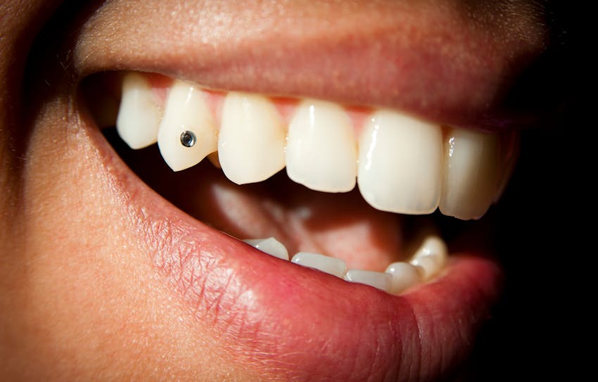 A persons teeth with a gem on one tooth