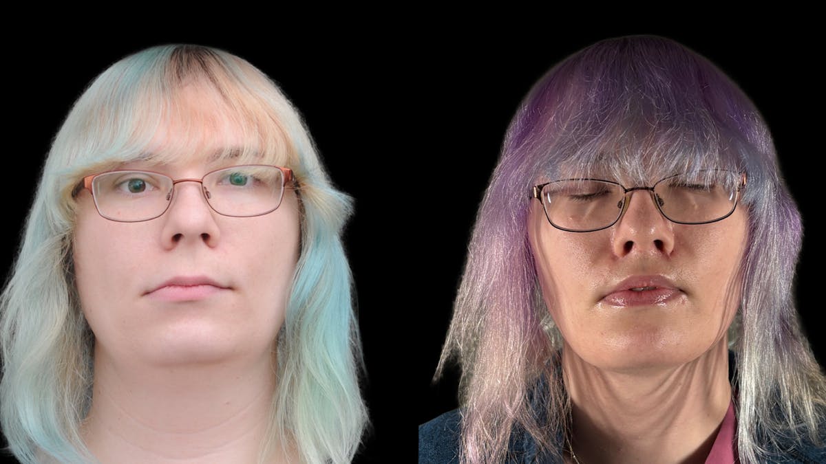 Facial Feminization Before & After Gallery - Patient 184029 - Image 2