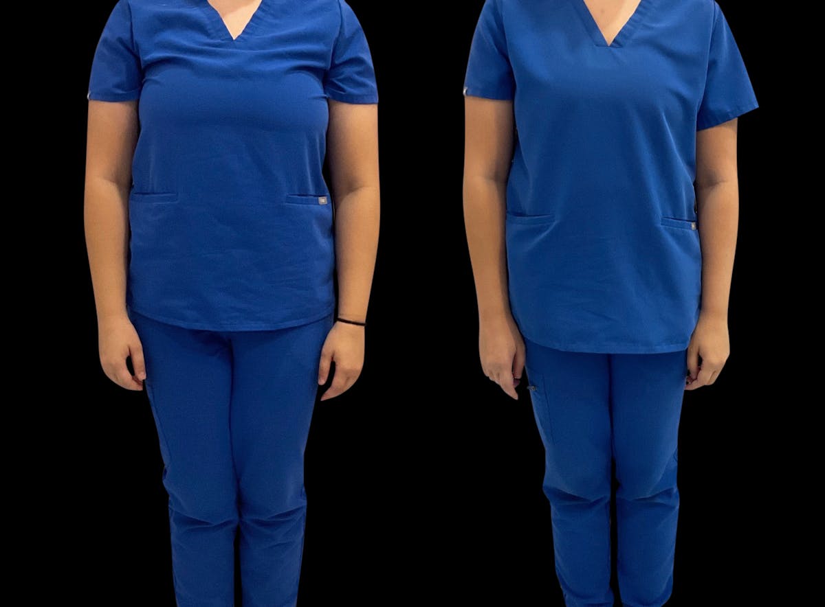 Weight Loss Before & After Gallery - Patient 210686 - Image 2