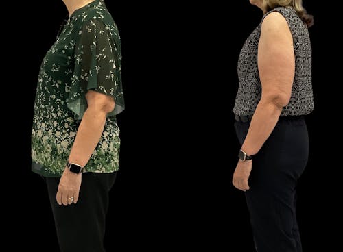 Weight Loss Treatments in Gilbert, AZ