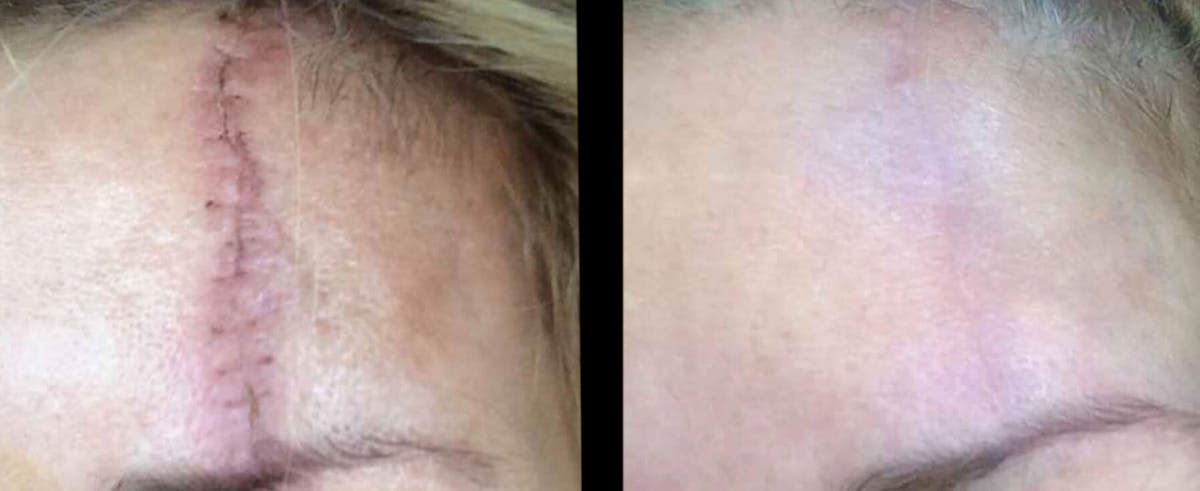 VivaMd Before & After Gallery - Patient 208597 - Image 1