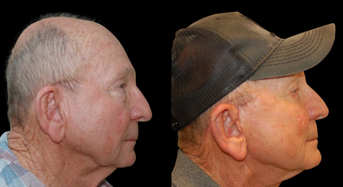 patient before and after images