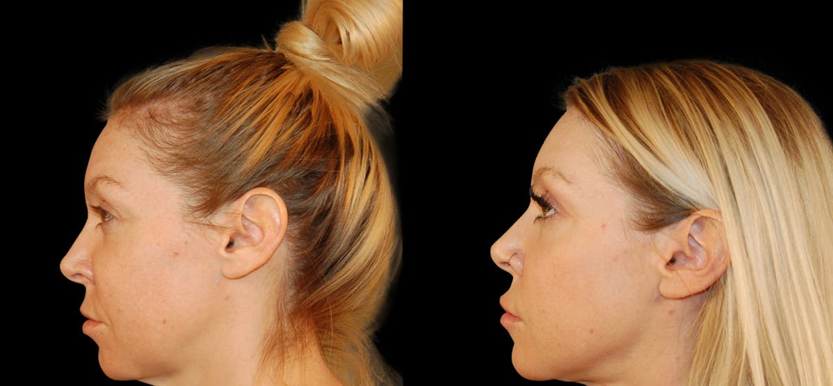 before and after images