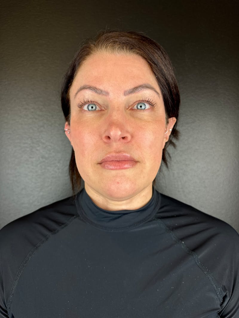 Comprehensive Treatment Plans Before & After Gallery - Patient 299186 - Image 2