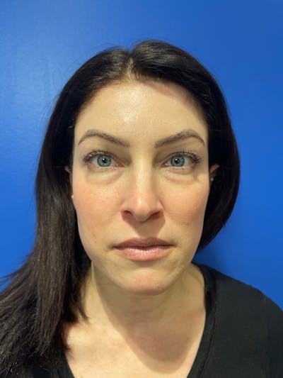 Comprehensive Treatment Plans Before & After Gallery - Patient 299186 - Image 1