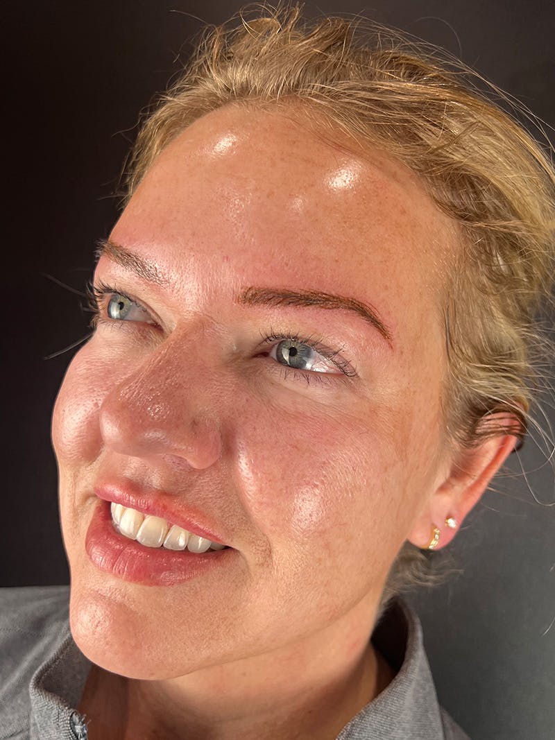 Microblading  Before & After Gallery - Patient 763399 - Image 2