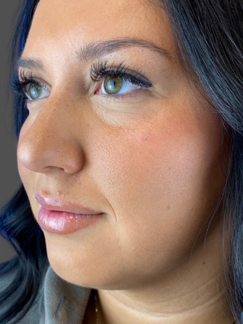 Comprehensive Treatment Plans Before & After Gallery - Patient 399928 - Image 1