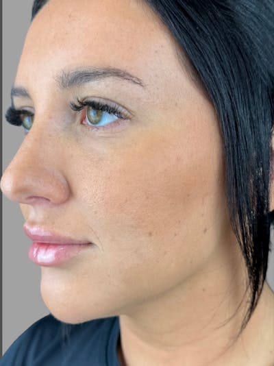 Comprehensive Treatment Plans Before & After Gallery - Patient 399928 - Image 2