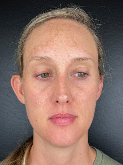 Comprehensive Treatment Plans Before & After Gallery - Patient 103565 - Image 1