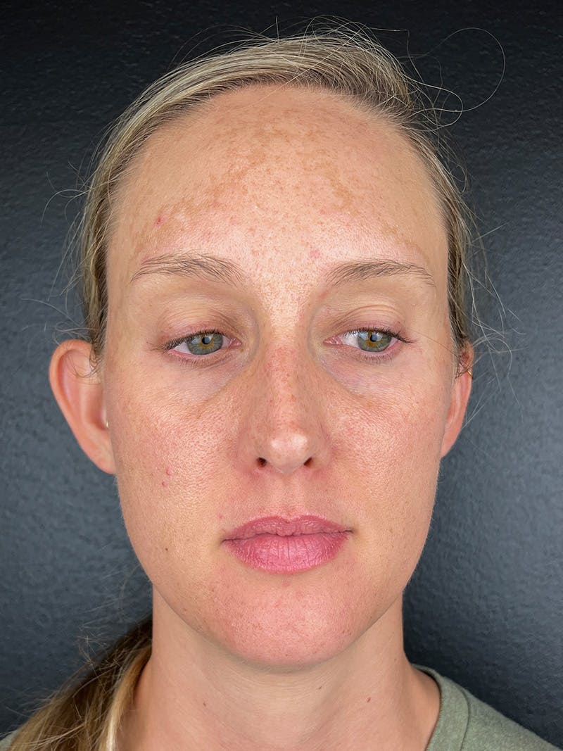 Comprehensive Treatment Plans Before & After Gallery - Patient 103565 - Image 1