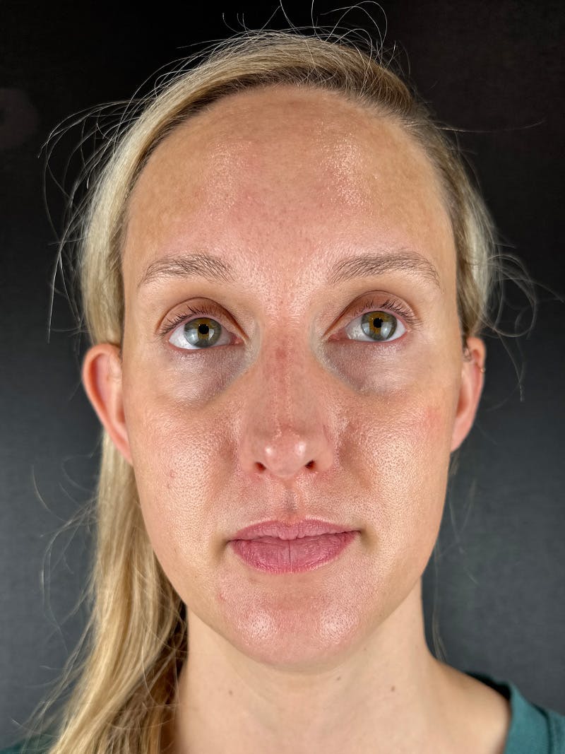 Comprehensive Treatment Plans Before & After Gallery - Patient 103565 - Image 2