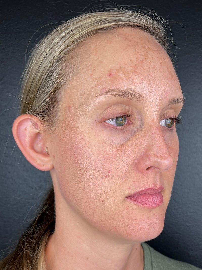 Comprehensive Treatment Plans Before & After Gallery - Patient 103565 - Image 3